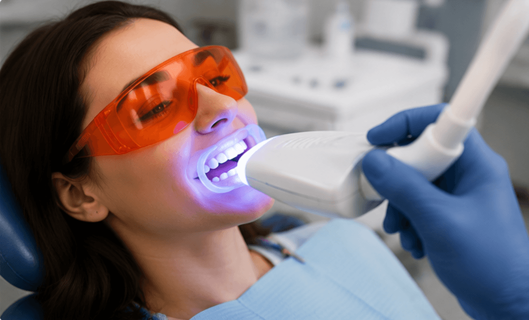 Professional Teeth Whitening: What You Should Know